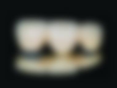 【宿州卡西瓦口腔门诊部参考价格表】