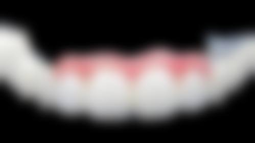 【宿州卡西瓦口腔门诊部特色诊疗项目】