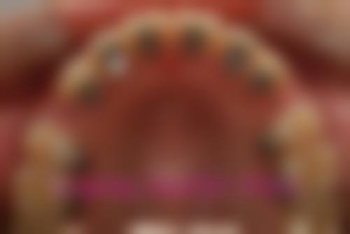 【儋州市人民医院口腔科参考价格表】