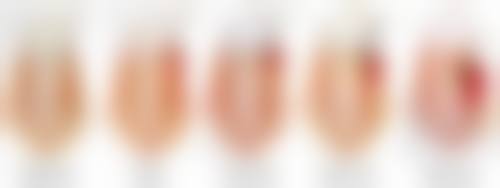 【天津伊诺口腔诊所参考价格表】
