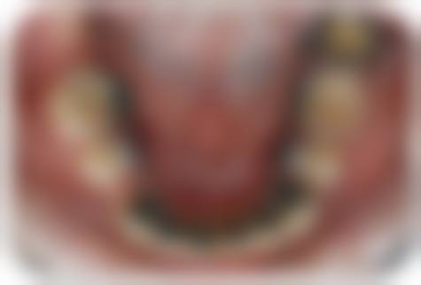 【重庆景佳口腔诊所常见问题解答FAQ】