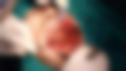 【泉州市中医院口腔科特色诊疗项目】