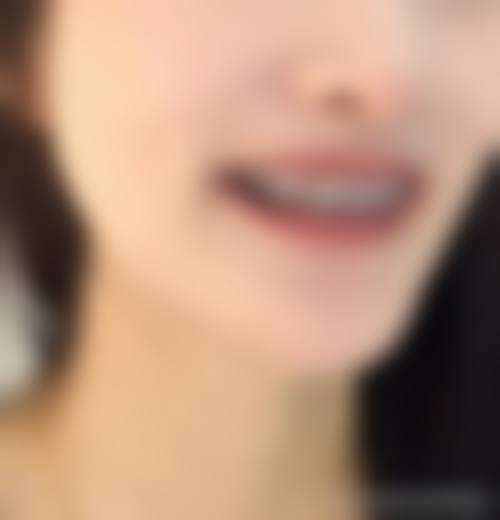 【(T)宁都县管江口腔门诊部特色诊疗项目】