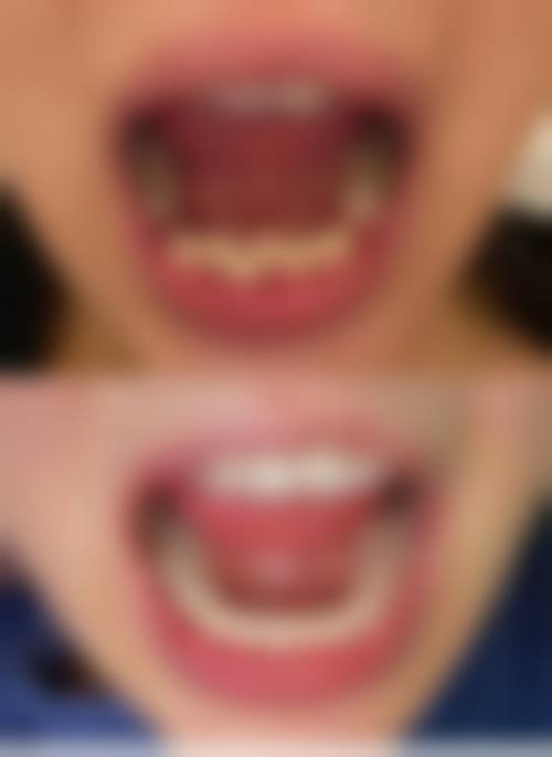 【湖南郴州宜章河马口腔门诊部真实口碑评价】