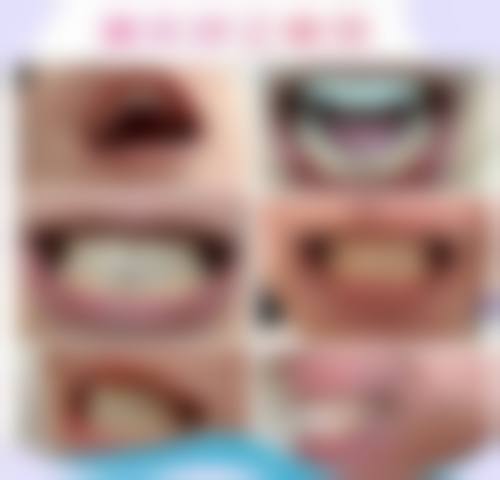【太原百适美口腔门诊部预约挂号方式与流程】