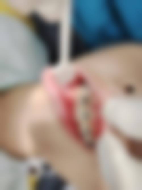 【呼和浩特咸禾华尔口腔门诊部真实口碑评价】
