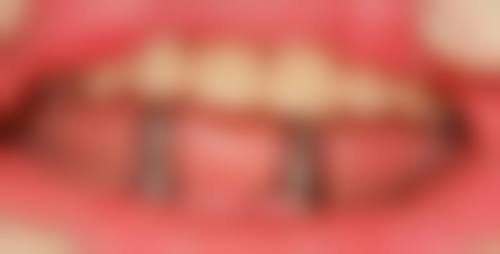 莱芜凤阳口腔常见问题FAQ