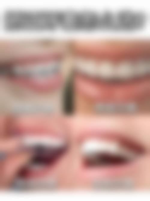 总结