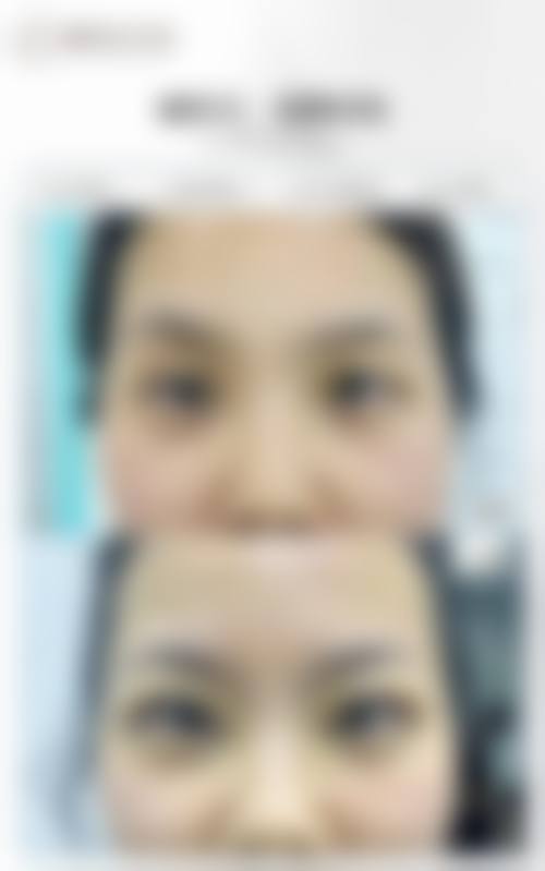 总结