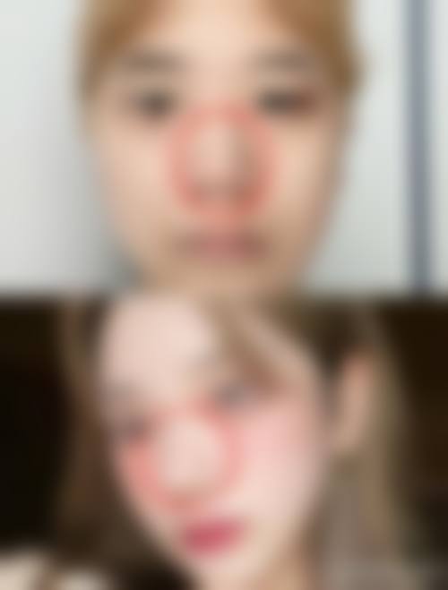 总结