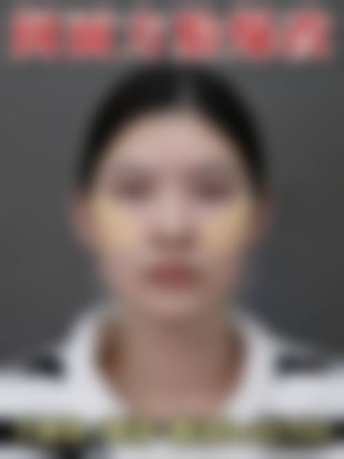 北京金燕子整形医疗美容医院常见问题FAQ