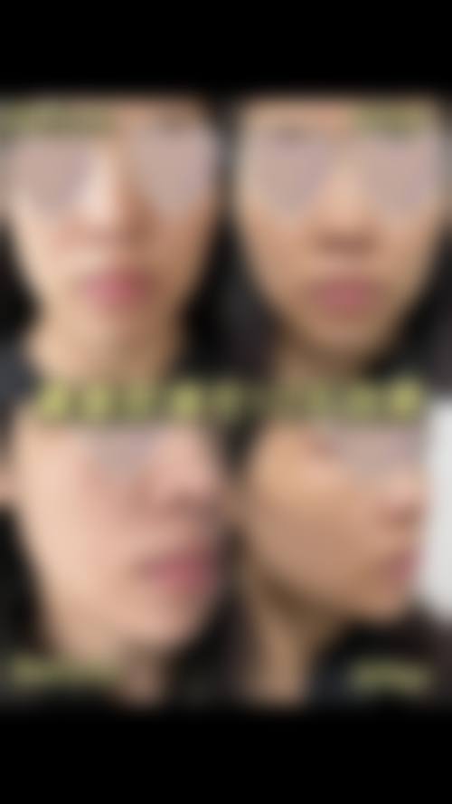 泰州奥莱医疗美容门诊部如何擅长项目