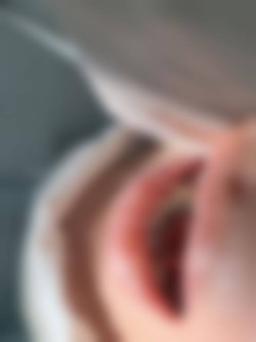 湖南长沙雅家馨口腔怎么预约?