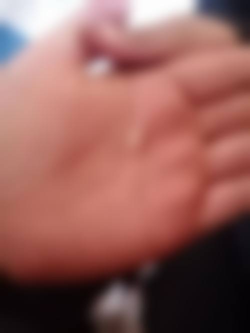 总结