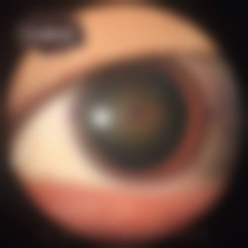 西安渭北眼科医院怎么预约?