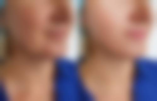 厦门新开元医院整形美容科常见问题FAQ