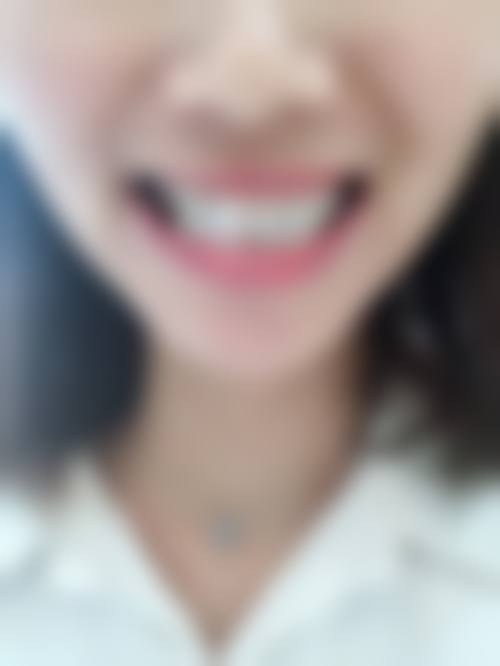 湖南长沙雅家馨口腔常见问题FAQ